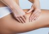 Ritenzione idrica, pesantezza e gonfiore alle gambe, cellulite: una soluzione c’è!